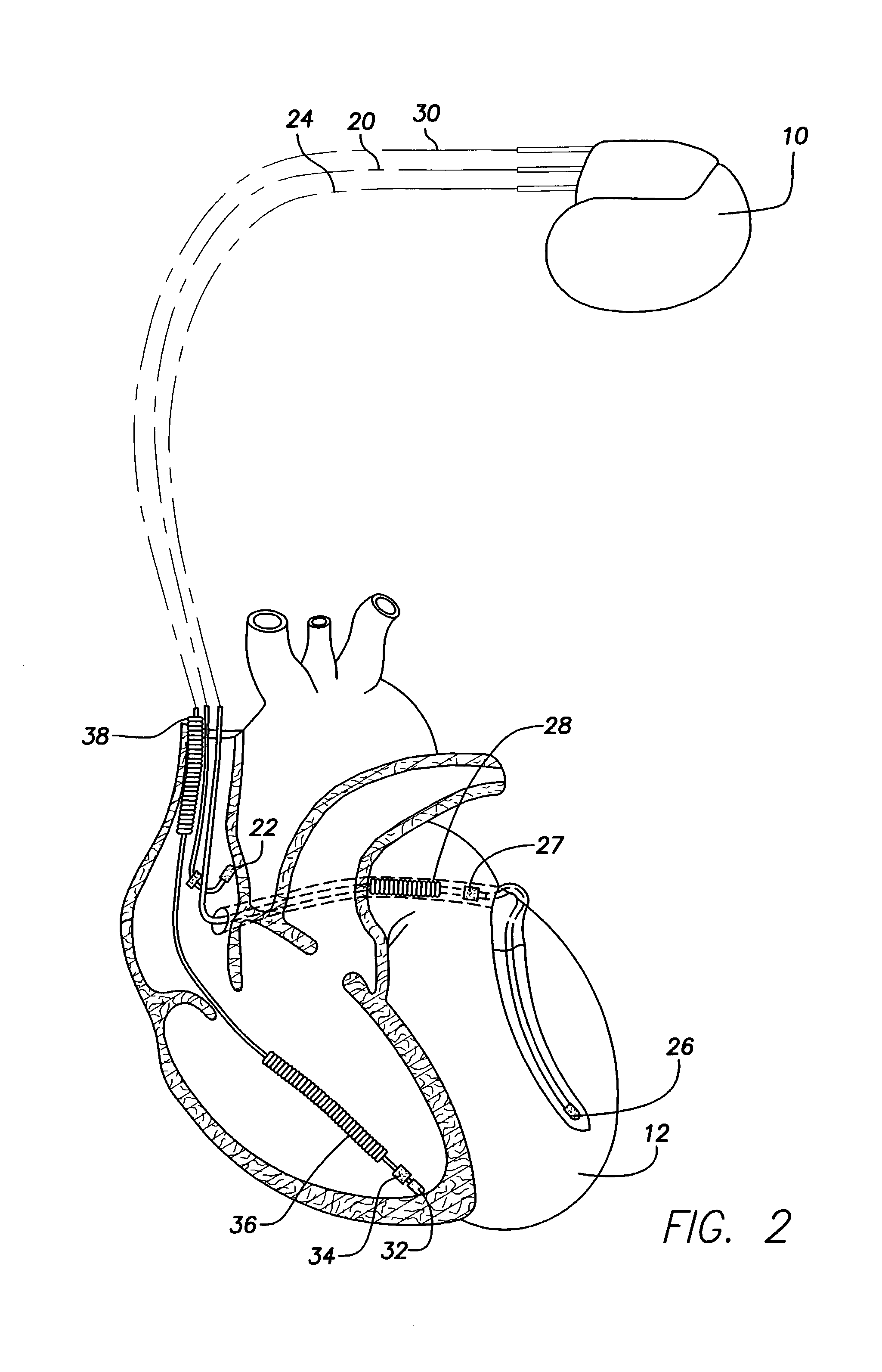 Method and apparatus for programming a rate responsive implantable cardiac stimulation device using user specified rate response functions