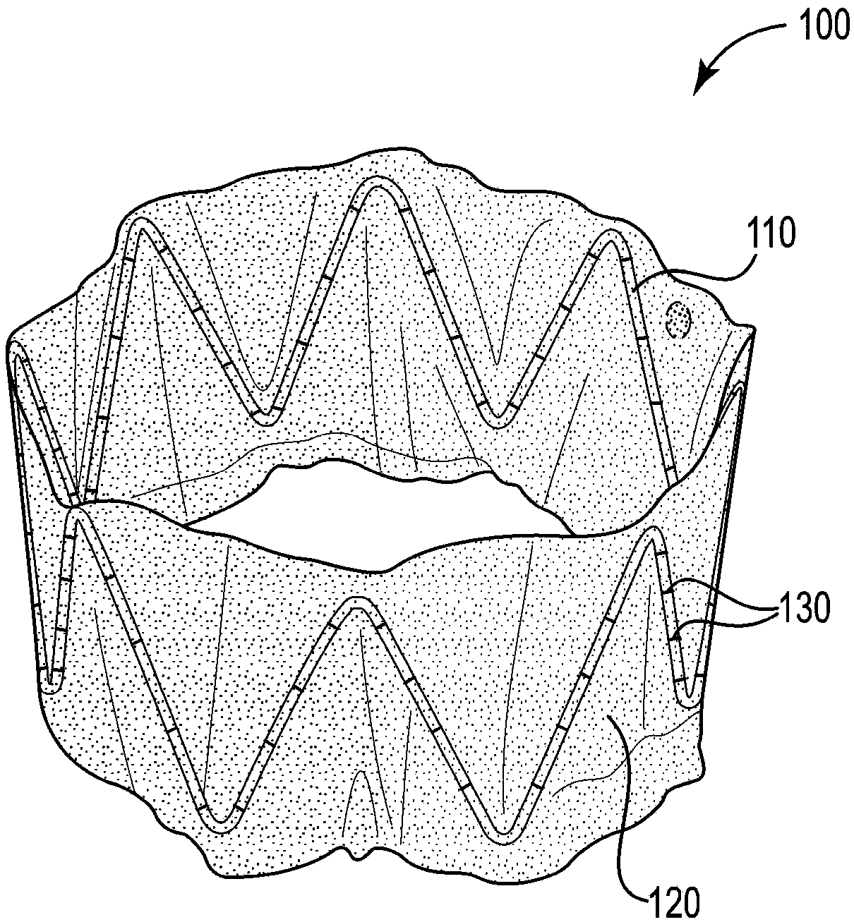 Sinus and nasal stent