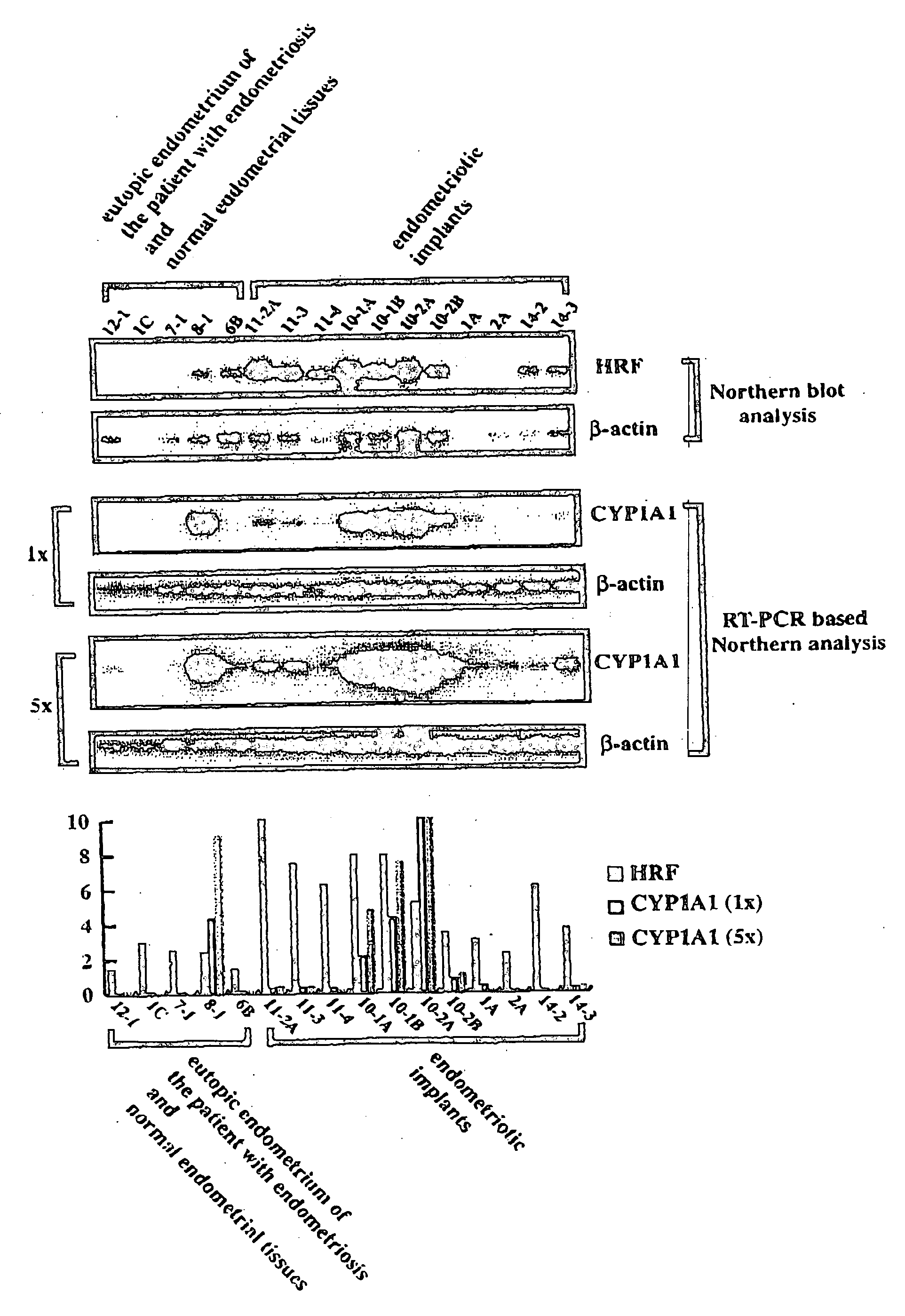 Method of diagnosing disease relating to endometriosis