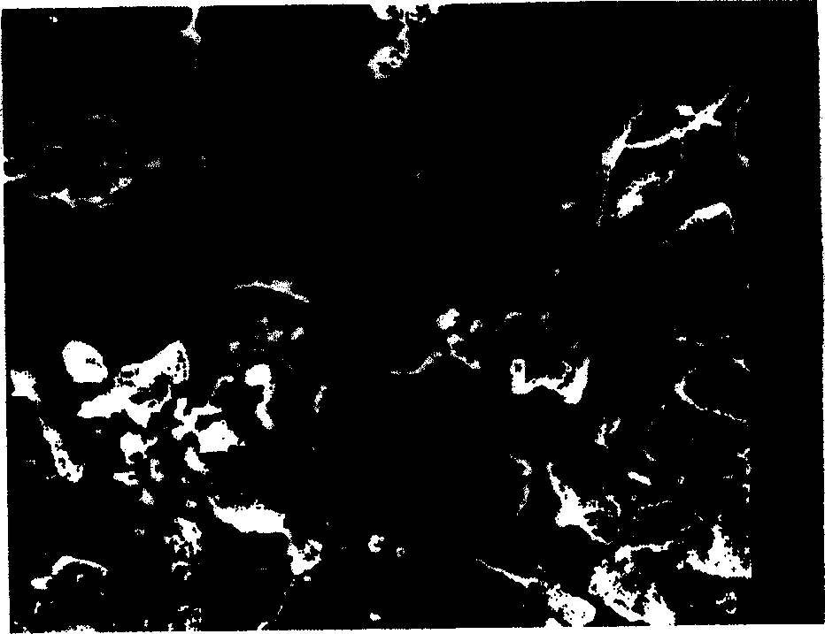 Method for preparing degradable biologically active artificial bone