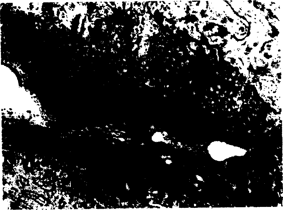 Method for preparing degradable biologically active artificial bone