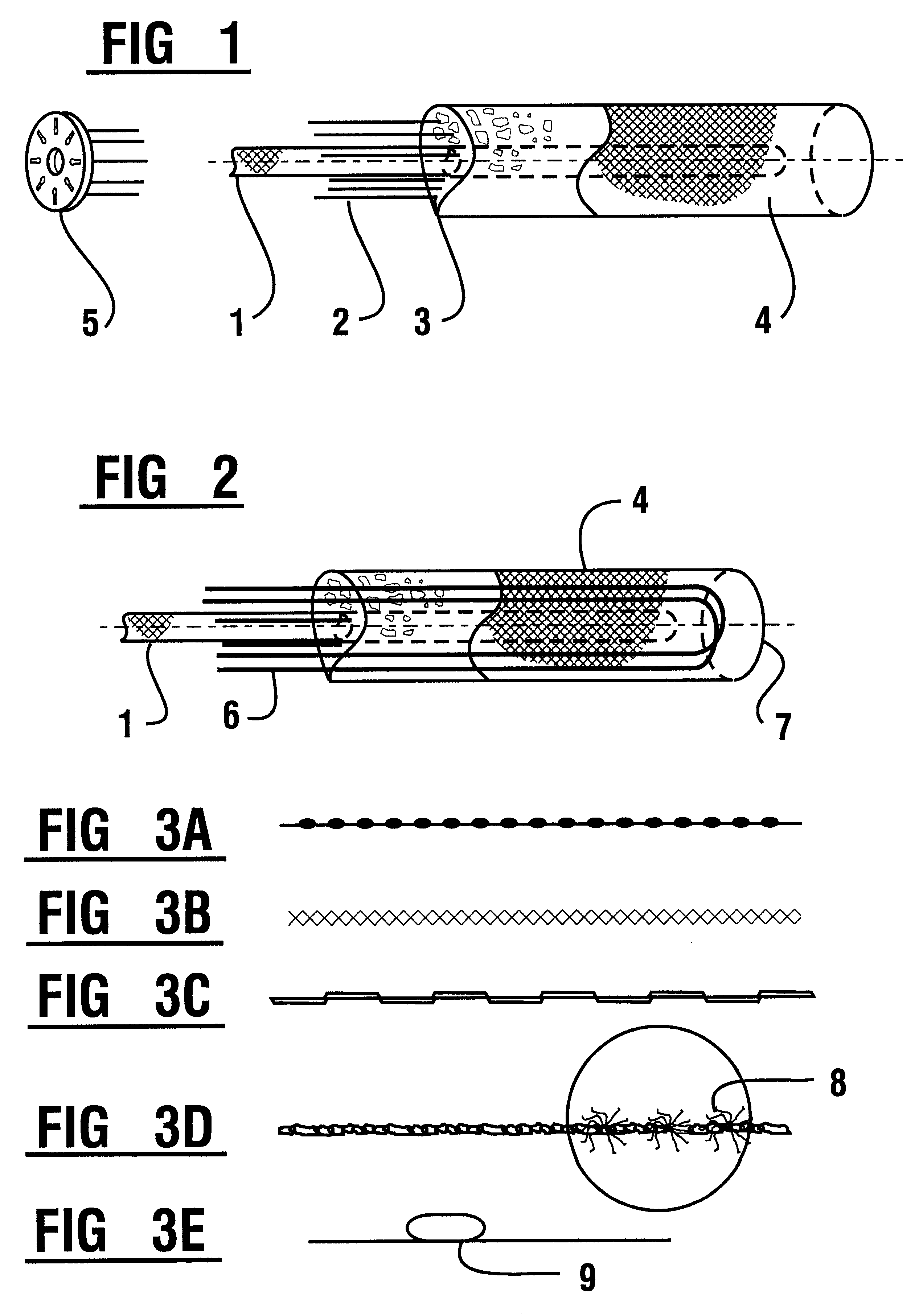 Injection anchor