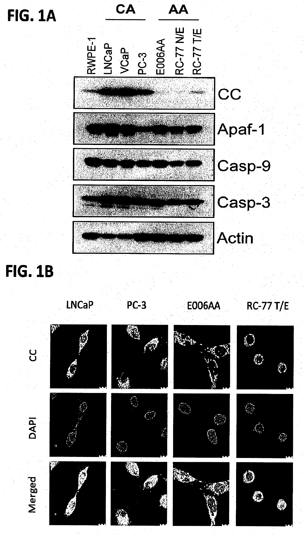 Methods and compositions for treating resistant and recurrent forms of cancer