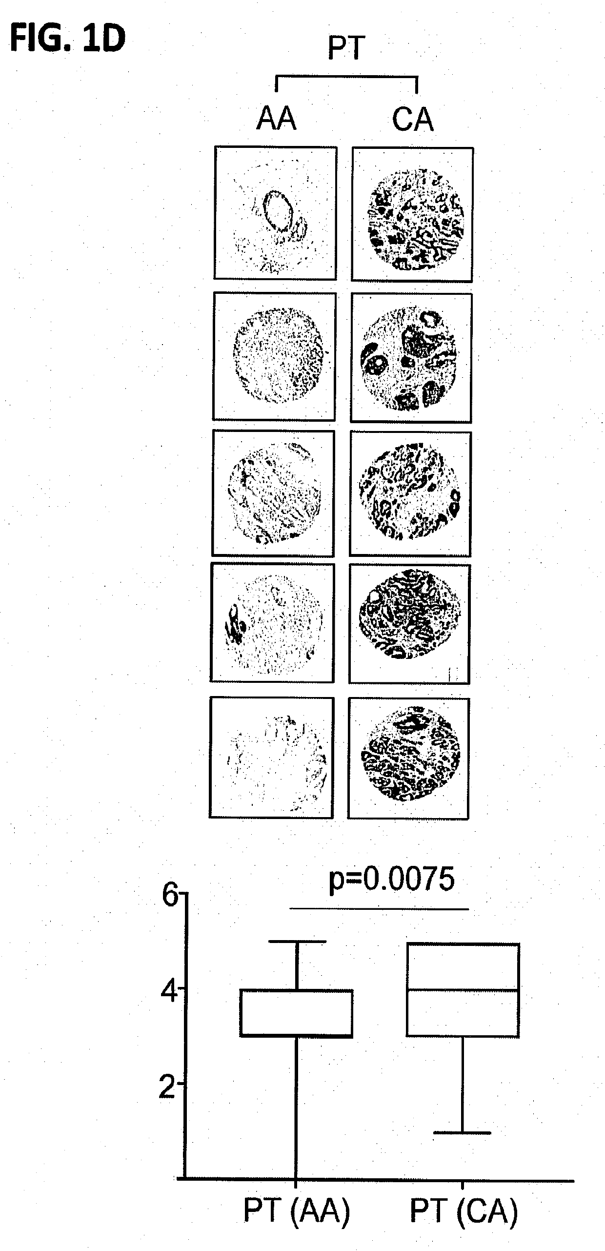 Methods and compositions for treating resistant and recurrent forms of cancer