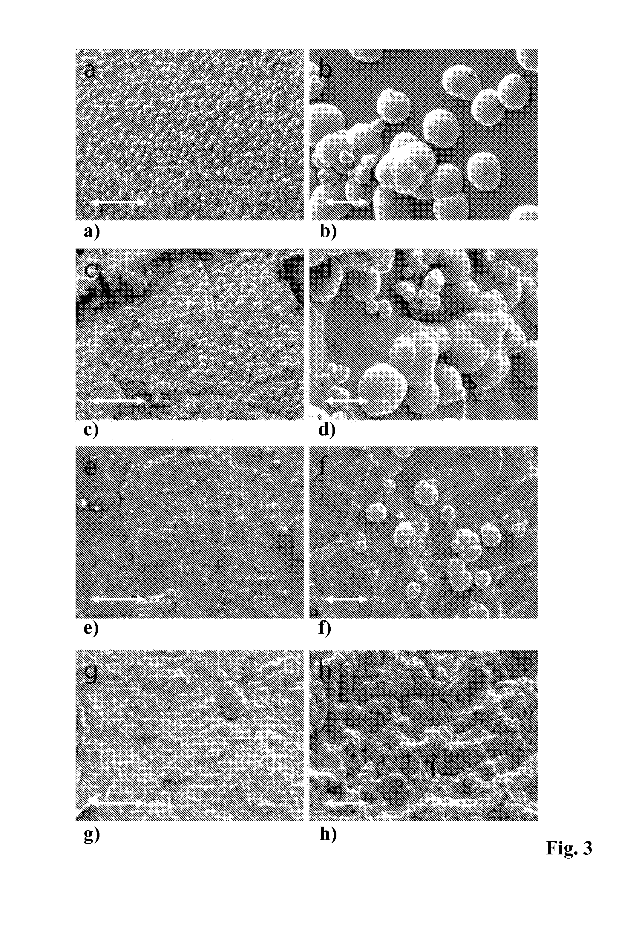 Composite material consisting of a collagen matrix mineralised with silicate and calcium phosphate phases, method for the production and use thereof