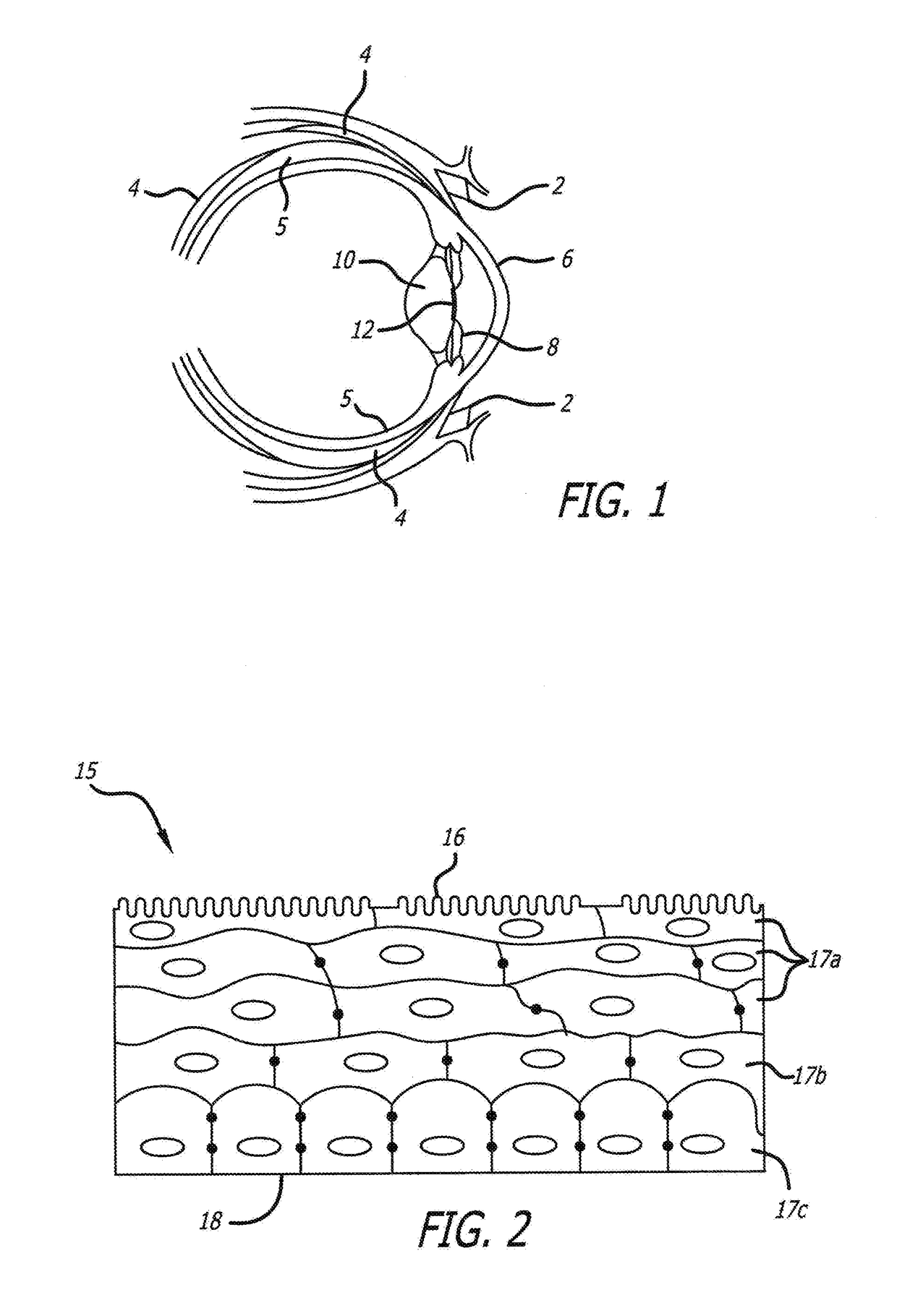 Device for Removing Colored Spots to Whiten the Eye