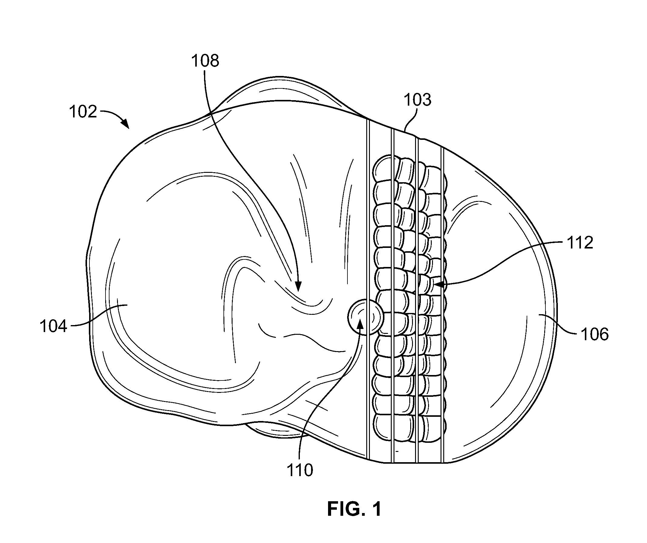 Morphologically curved sagittal wall of a tibial implant