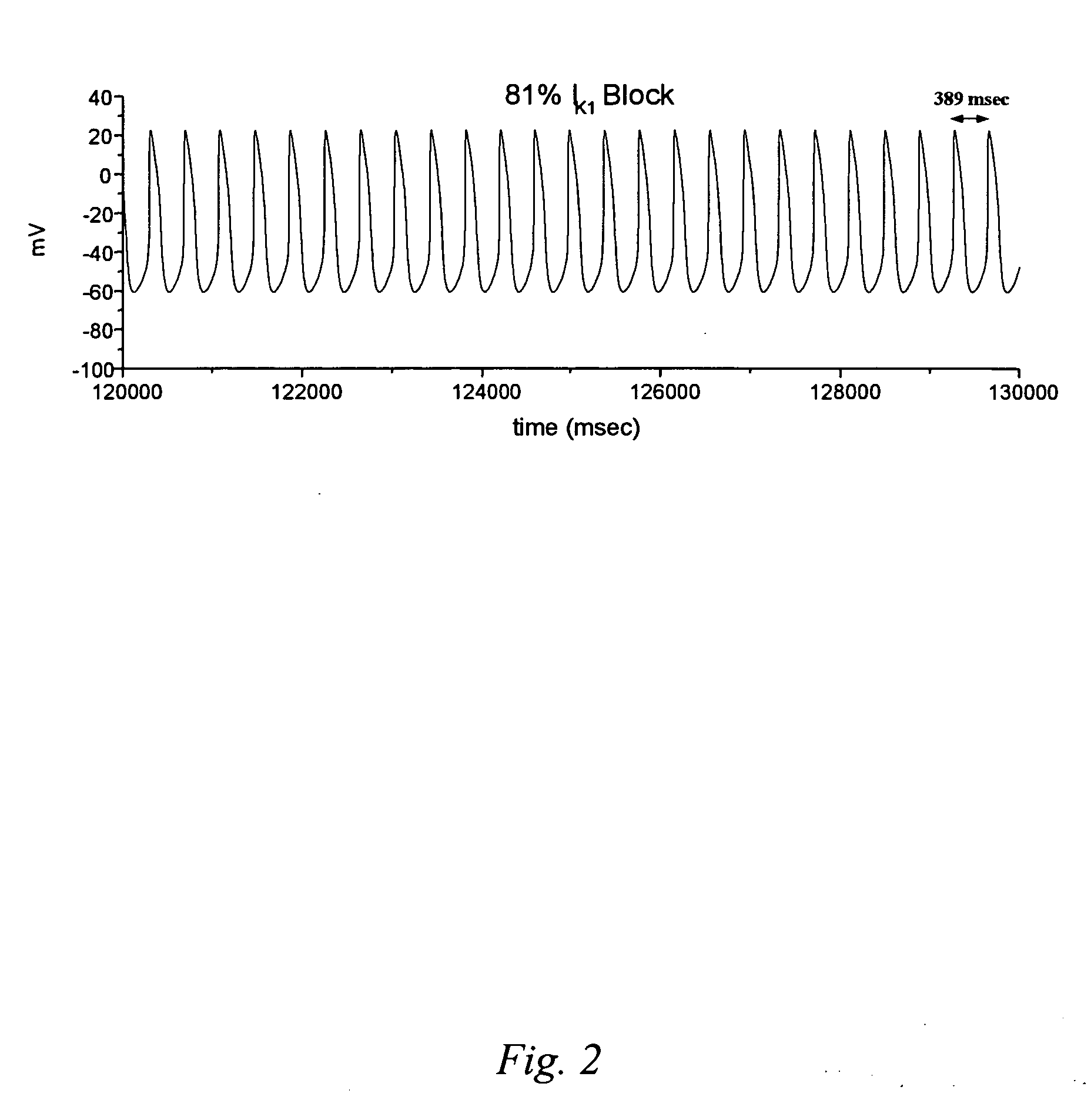 Methods of treating cardiac disorders by suppressing the expression of the potassium inwardly-rectifying channel