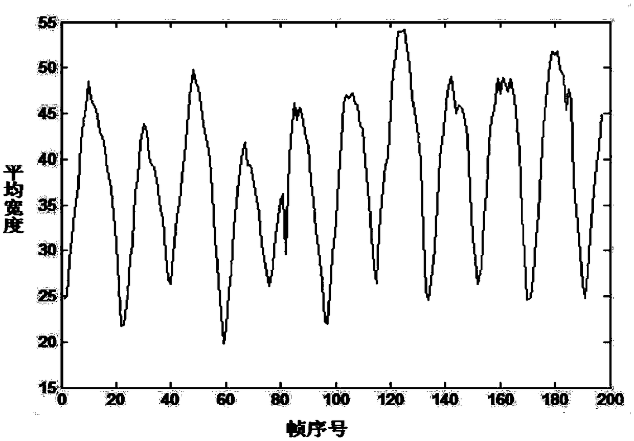 Gait recognition method based on motion time series energy graph