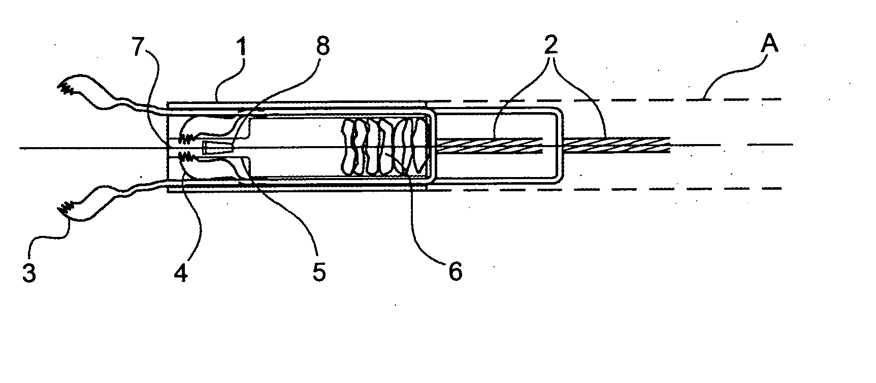 Apparatus for removable distal internal cassette for in situ fixation and specimen processing with serial collection and storage of biopsy specimens