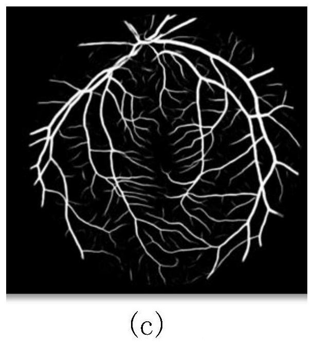 A Retinal Vessel Segmentation Method Based on Convolutional Neural Network