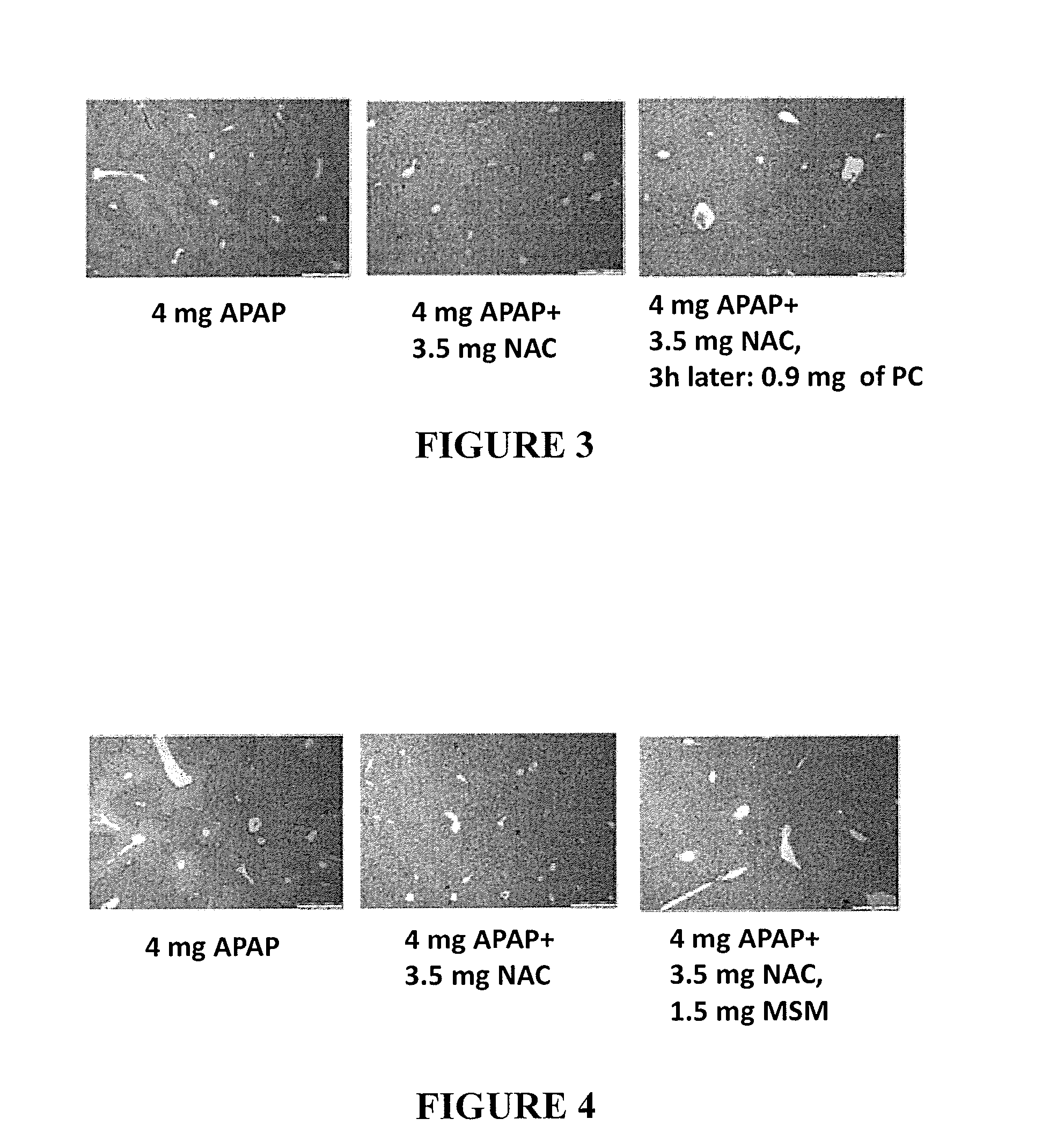 Compositions And Methods For Amelioration And Prevention Of Drug-Induced Toxicity