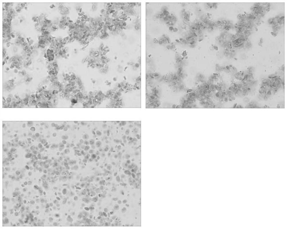 Method for extracting chloroplast of kok-saghyz