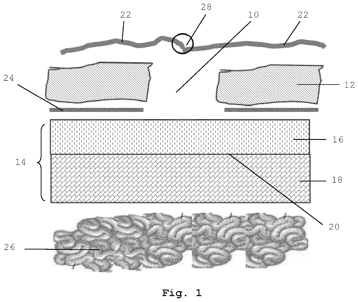 Biodegradable Two-Layered Matrix for Preventing Post-Surgical Adhesions