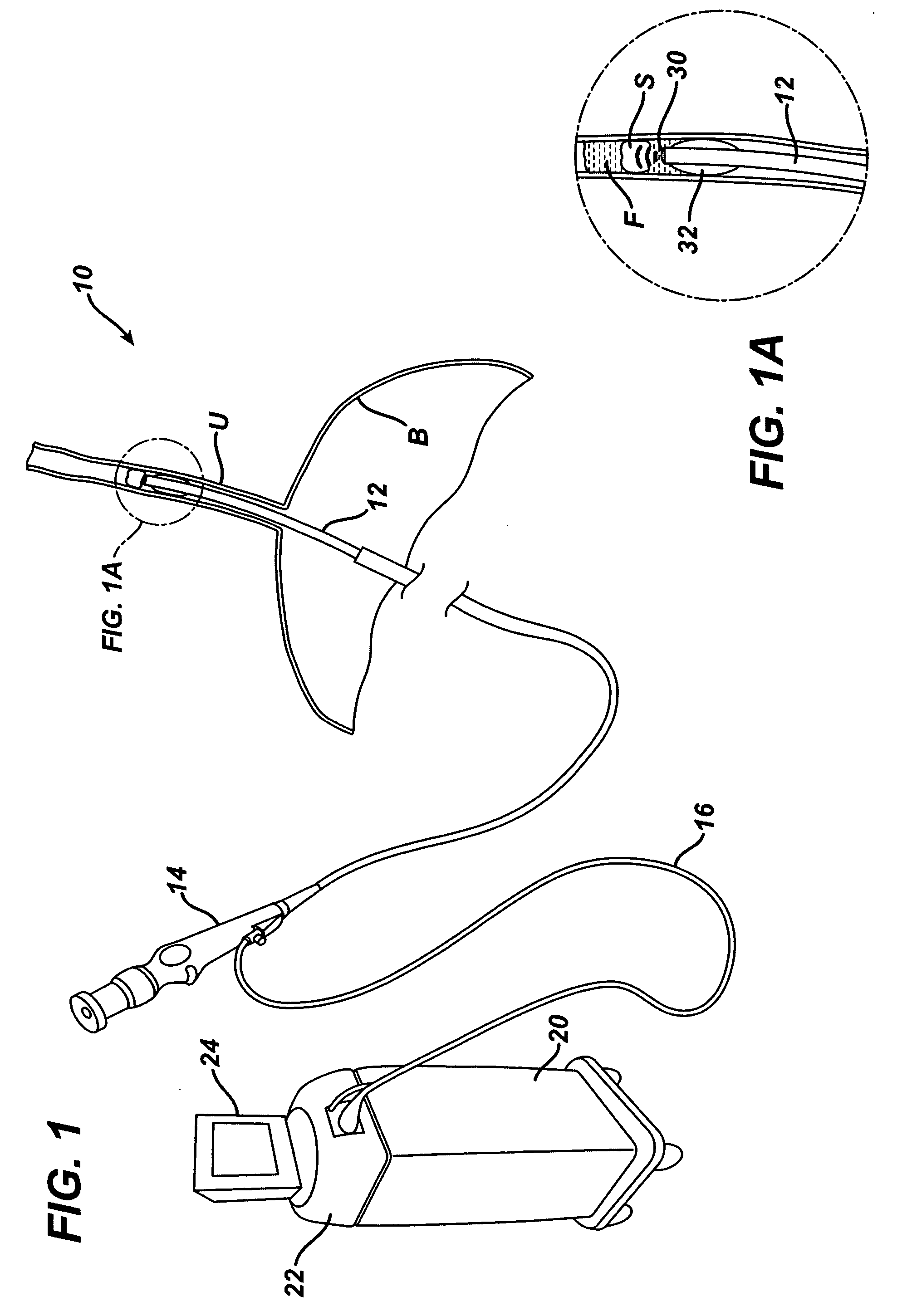 Ultrasonic device and method for treating stones within the body