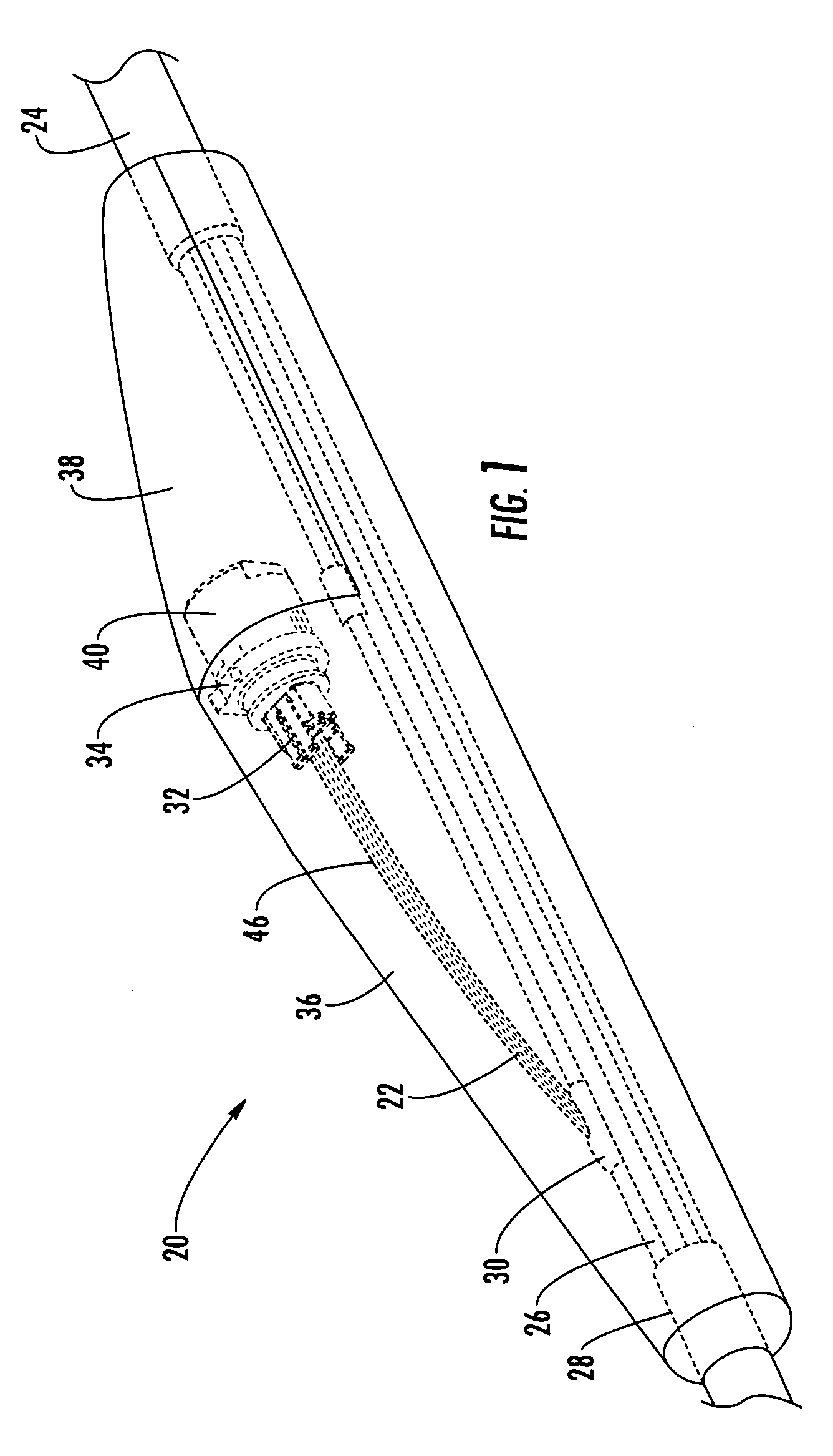 Pre-connectorized fiber optic distribution cable having overmolded access location