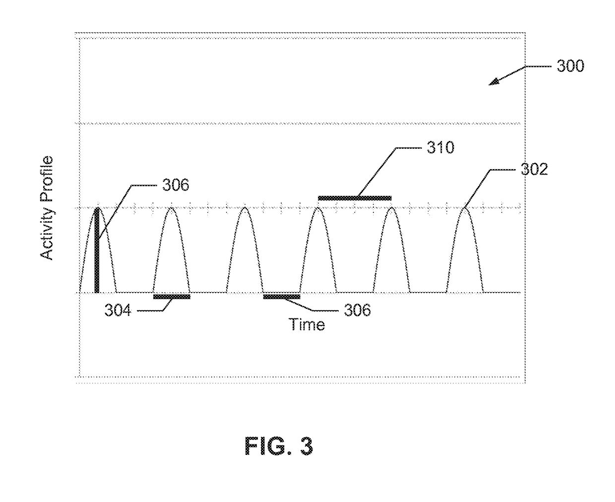 Neural Monitoring Methods and Systems for Treating Pharyngeal Disorders