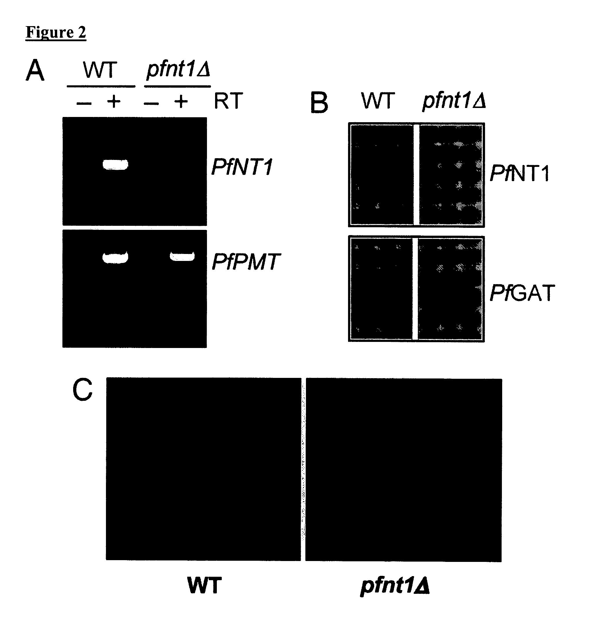 Use of conditional plasmodium strains lacking nutrient transporters in malaria vaccination