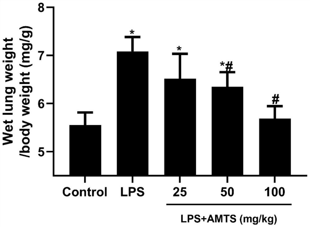 Use of methallyl trisulfide in the preparation of medicines for treating acute lung injury