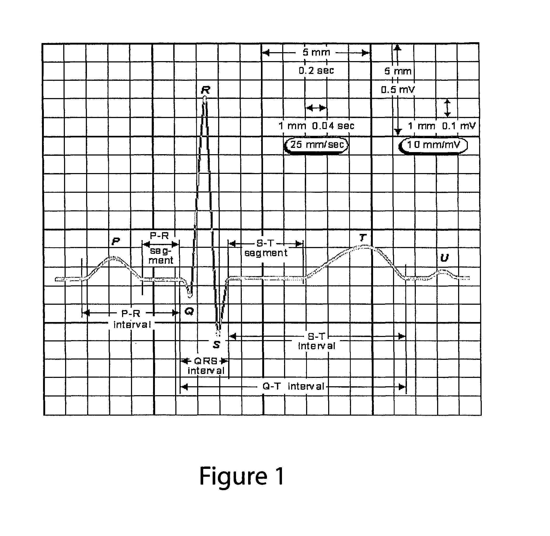 System, method and apparatus for detecting a cardiac event