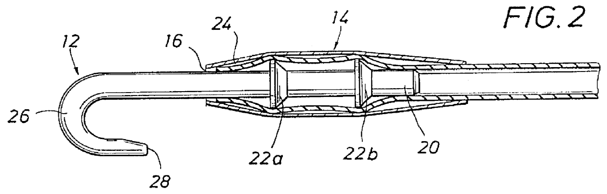 Plastic stay assembly for use with MRI and X-ray imaging systems