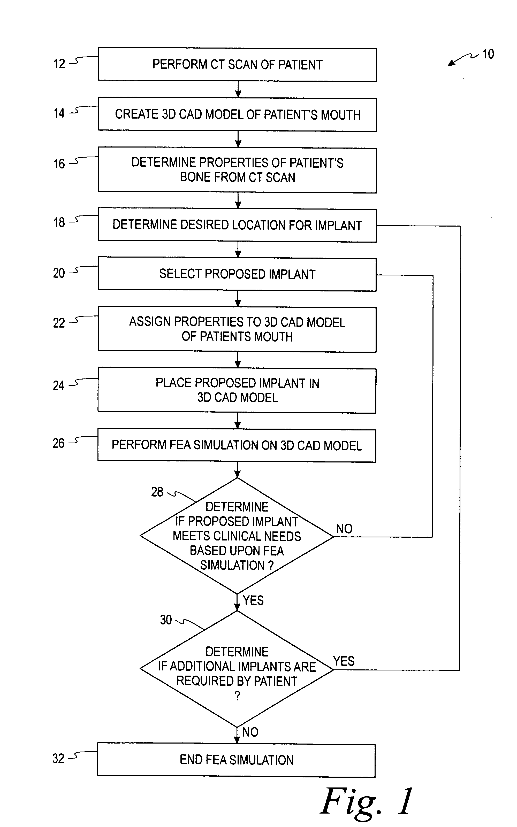 Method for selecting implant components