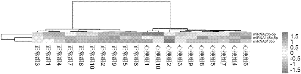 Application of exosome small-molecule RNA to risk assessment of acute myocardial infarction