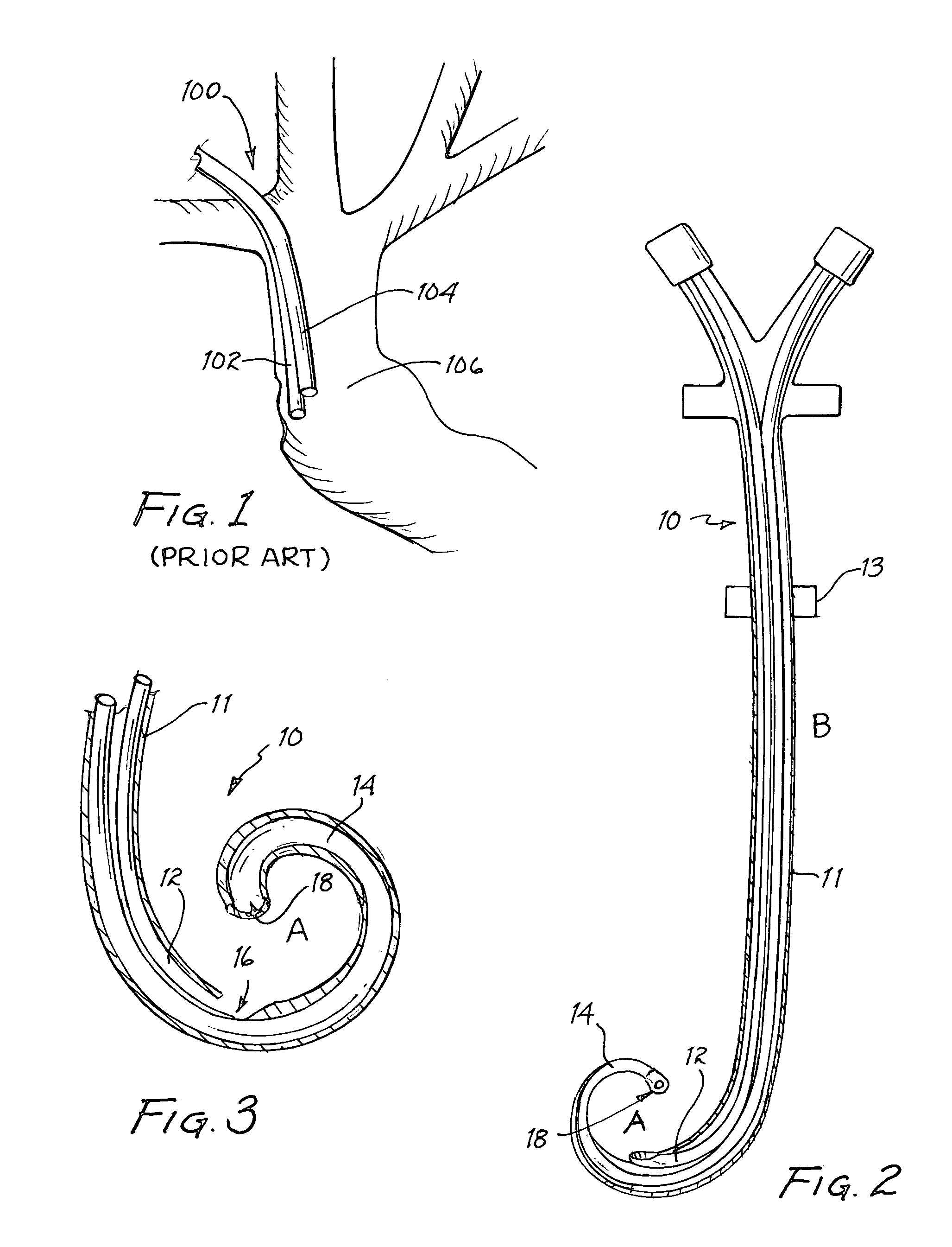 Vascular access catheter having a curved tip and method