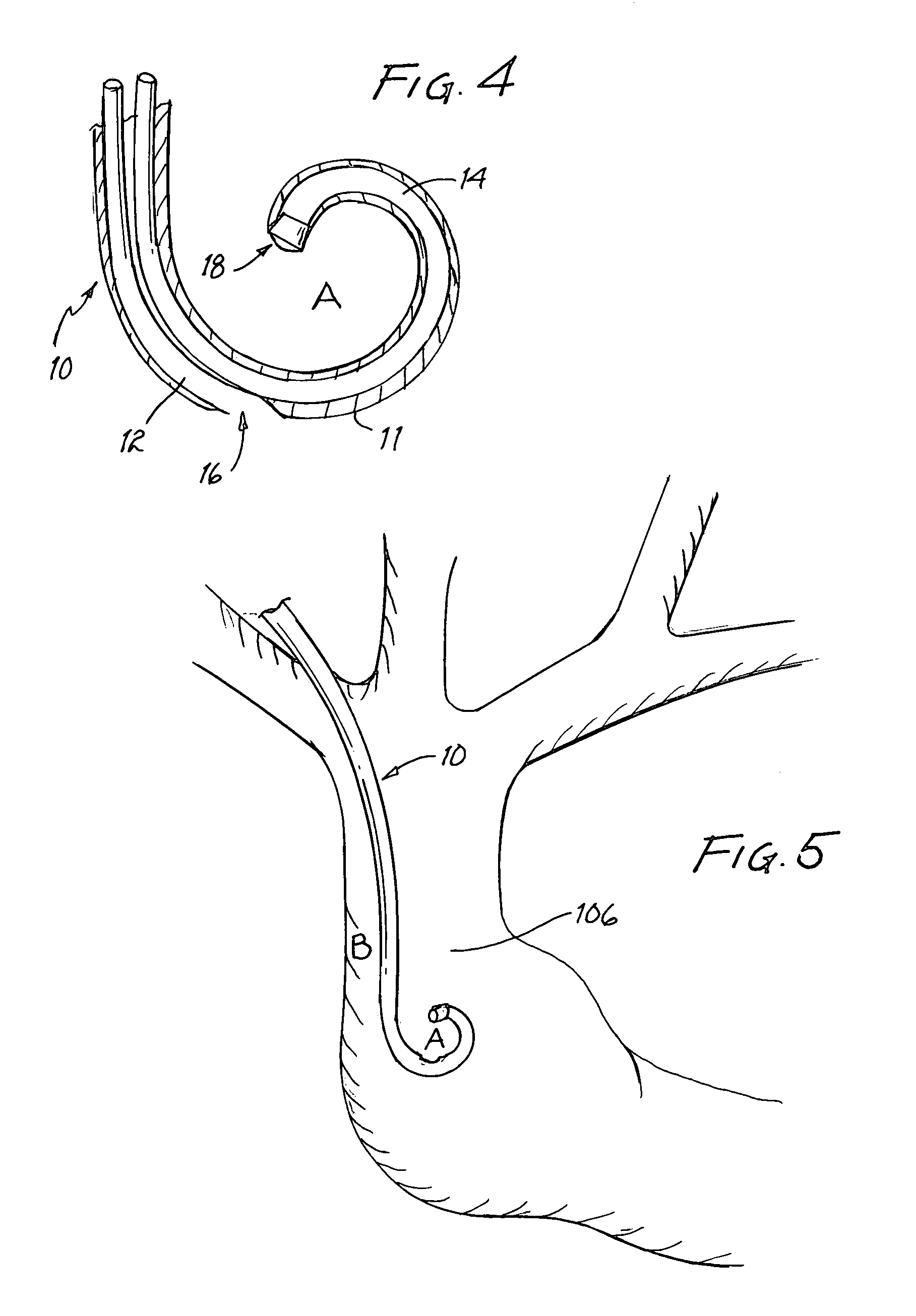 Vascular access catheter having a curved tip and method