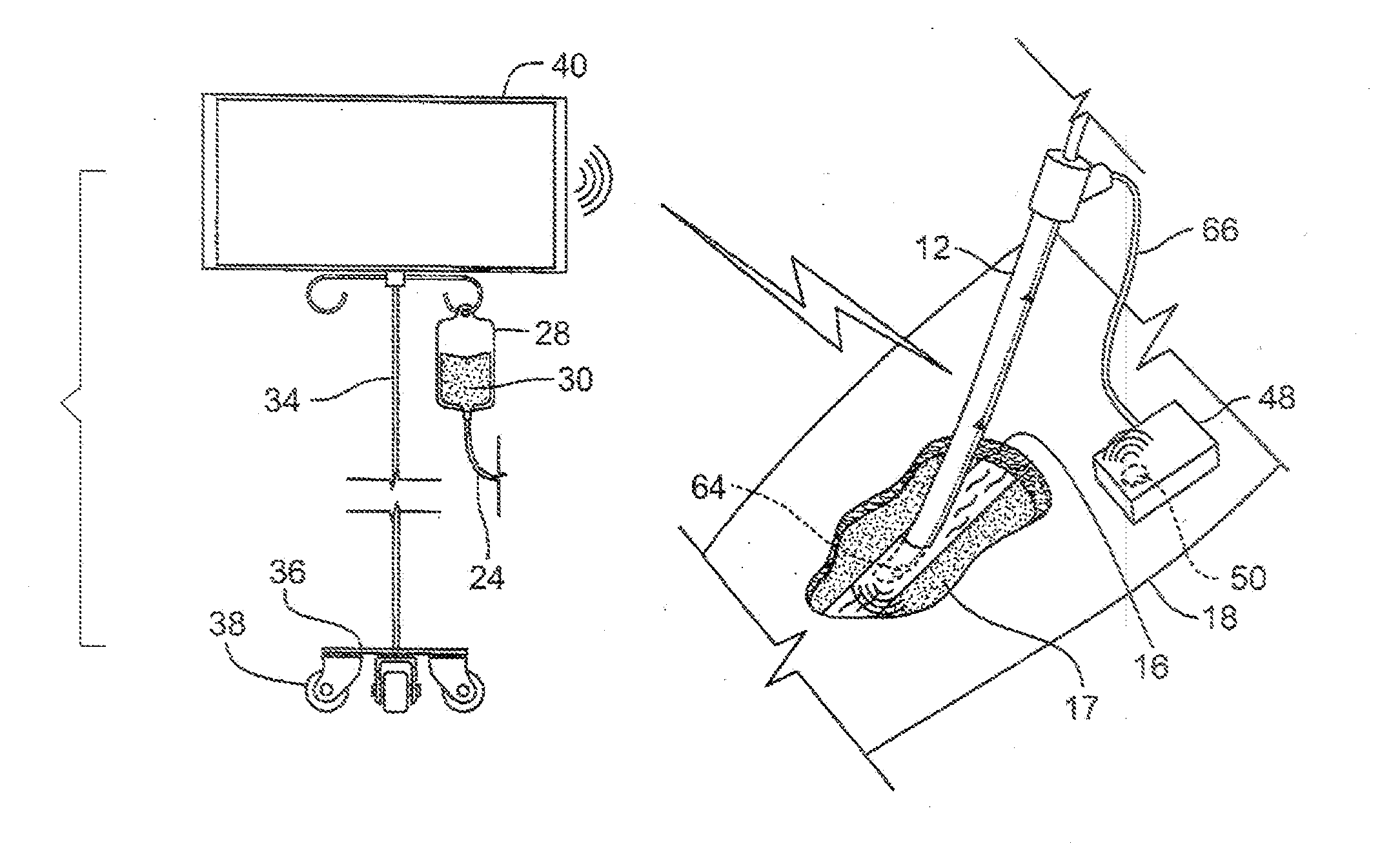 Intravenous apparatus and method