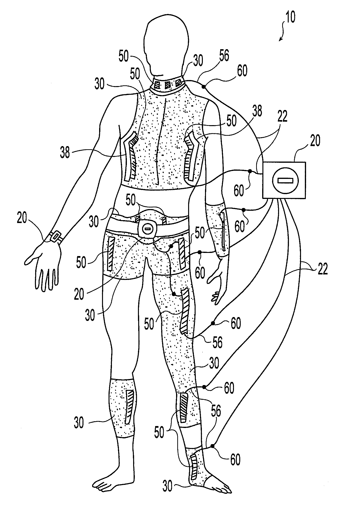 System and device for neuromuscular stimulation