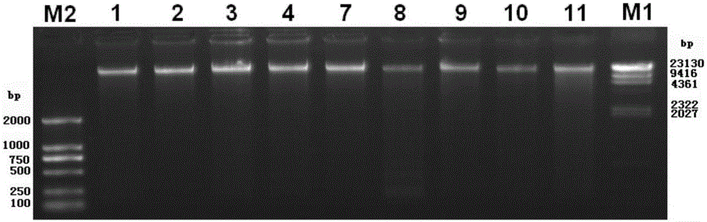 A sputum collection method for the detection of respiratory bacteria 16s rRNA gene sequence