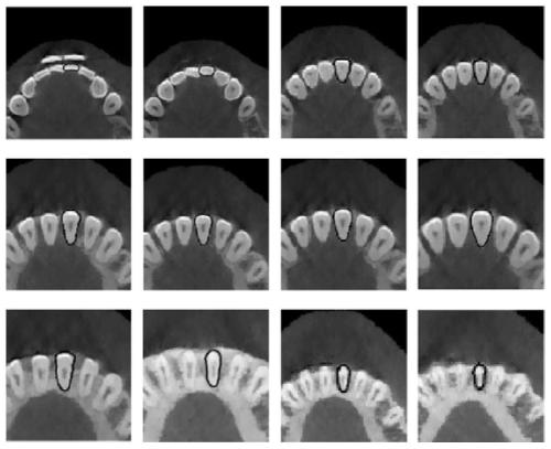 CT image based porous implant making method and system