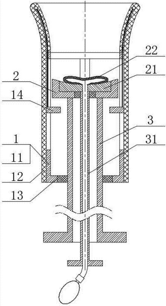 Uterine Inversion correcting and resetting machine