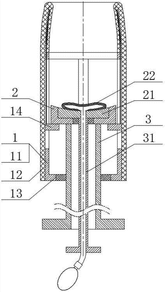 Uterine Inversion correcting and resetting machine