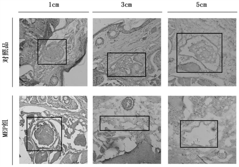 Preparation process of morchella polysaccharide and novel application thereof in prevention and treatment of thrombus and diseases caused by thrombus