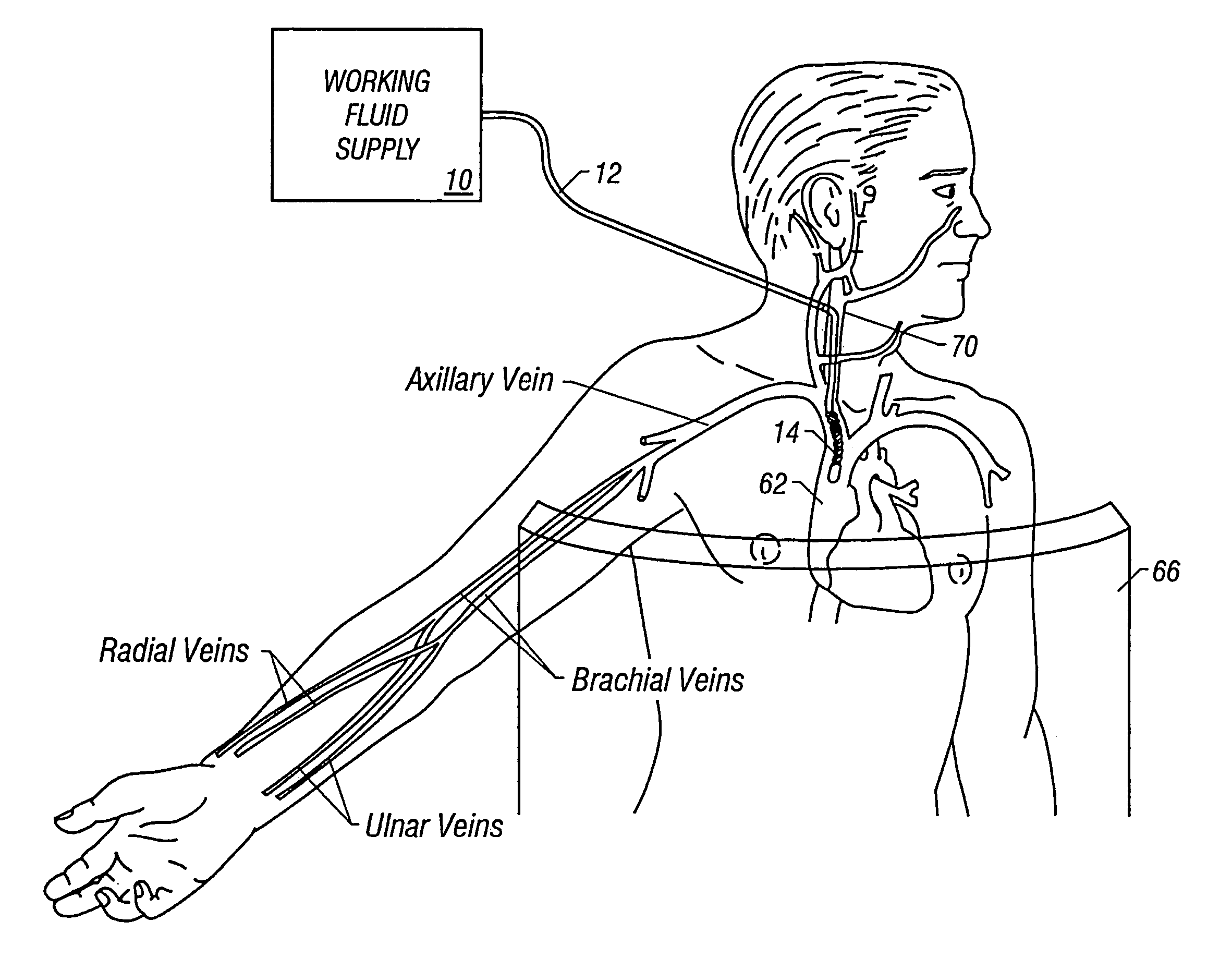 Patient temperature regulation method and apparatus