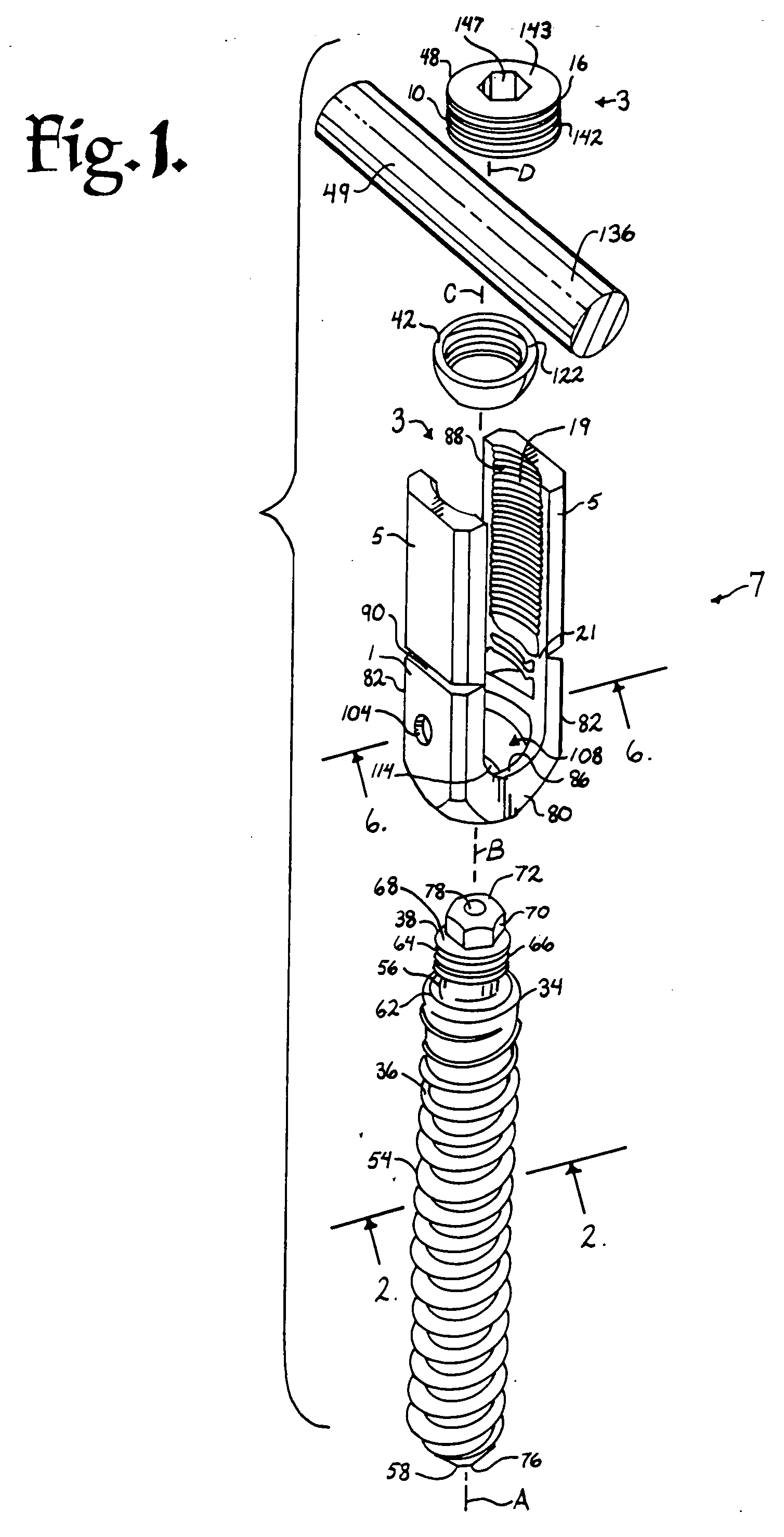 Helical reverse angle guide and advancement structure with break-off extensions