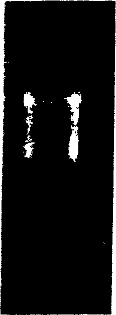 Method for obtaining human copper and zinc superoxide dismutase genes from human body