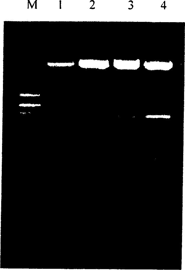 Method for obtaining human copper and zinc superoxide dismutase genes from human body