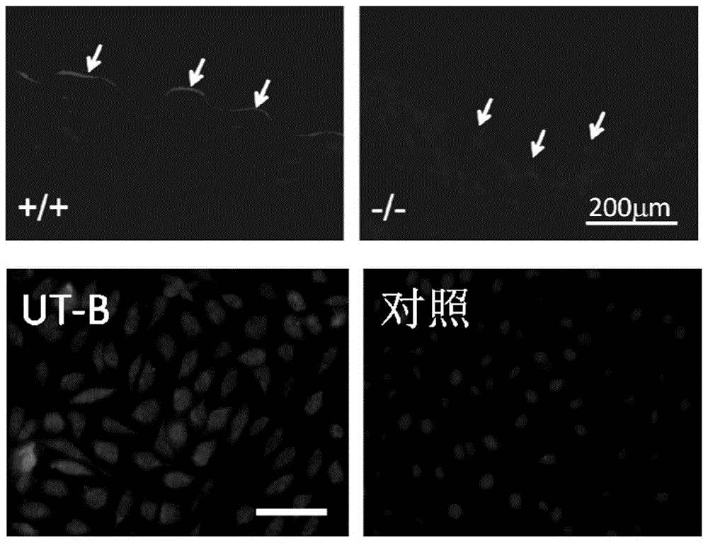 Application of 1-[2-(3-amino-6-methylthieno[2,3-b]quinolyl)]ethanone in the preparation of vasodilators