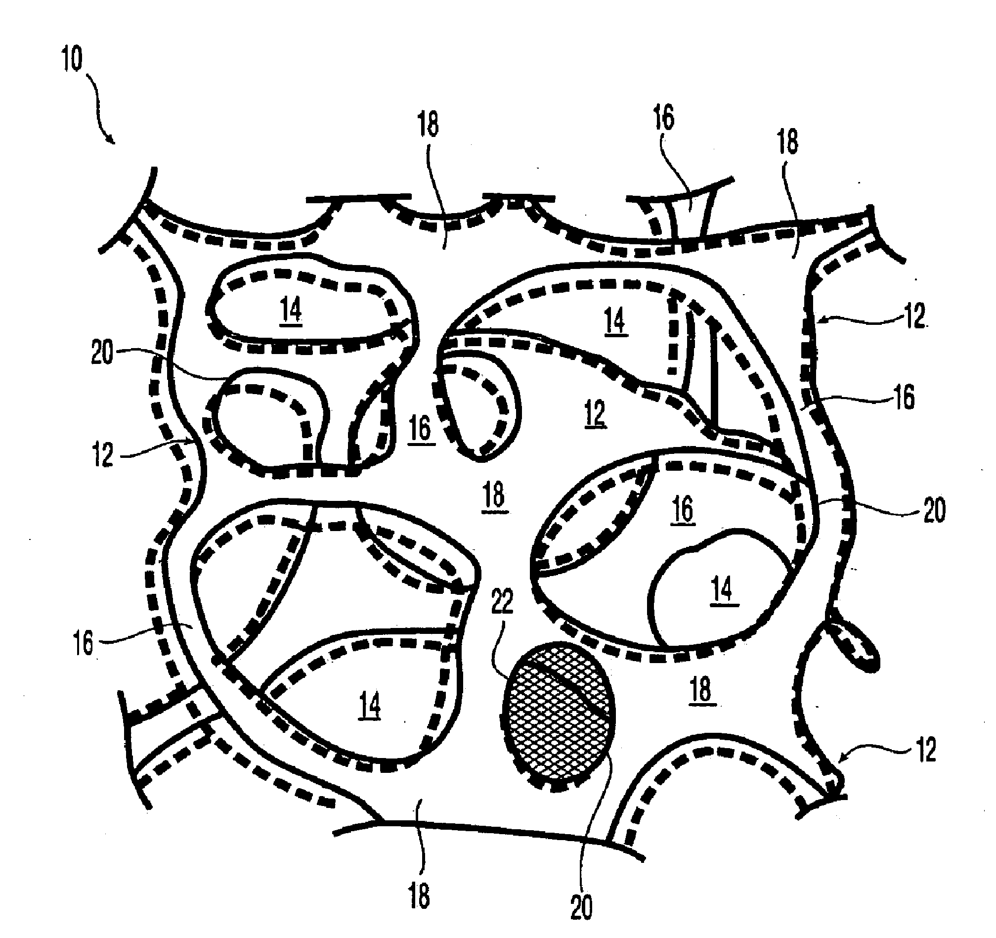 Composite mesh devices and methods for soft tissue repair