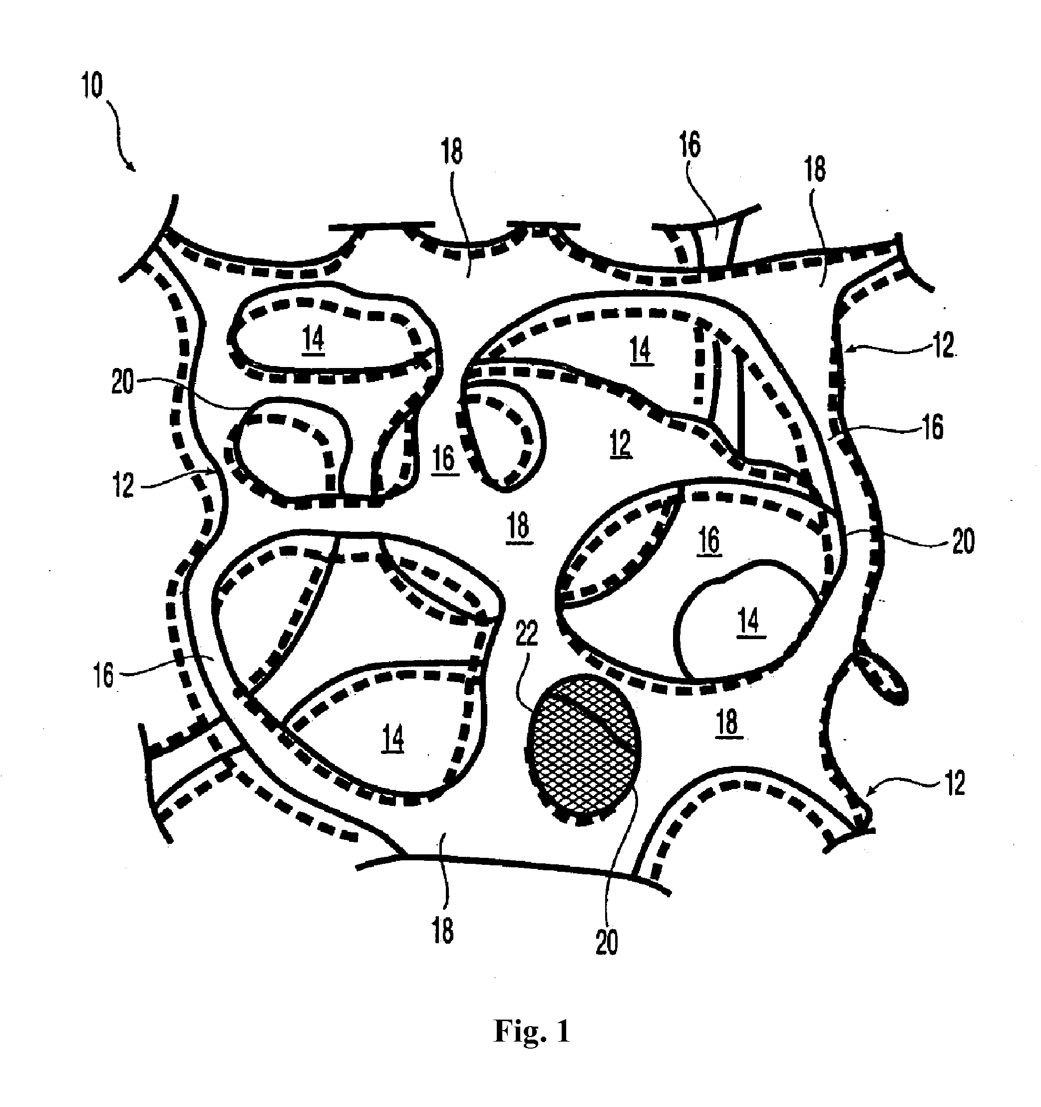 Composite mesh devices and methods for soft tissue repair