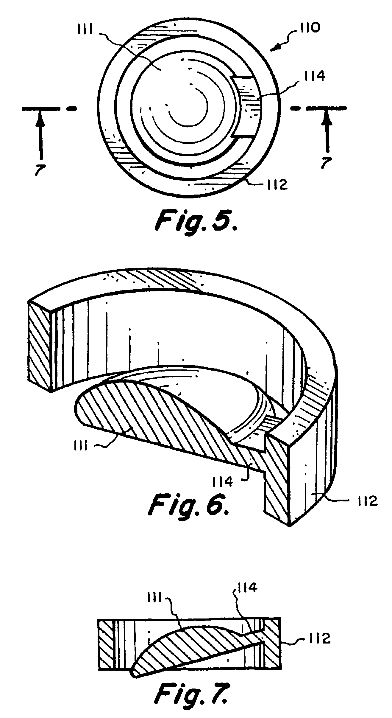 Valve mounting assembly for voice prosthesis-cartridge and ring