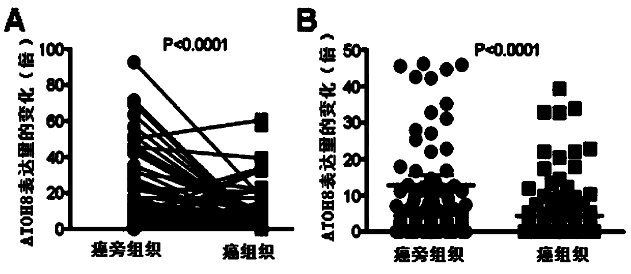 Cancer suppressor gene ATOH8 and application of encoding protein thereof