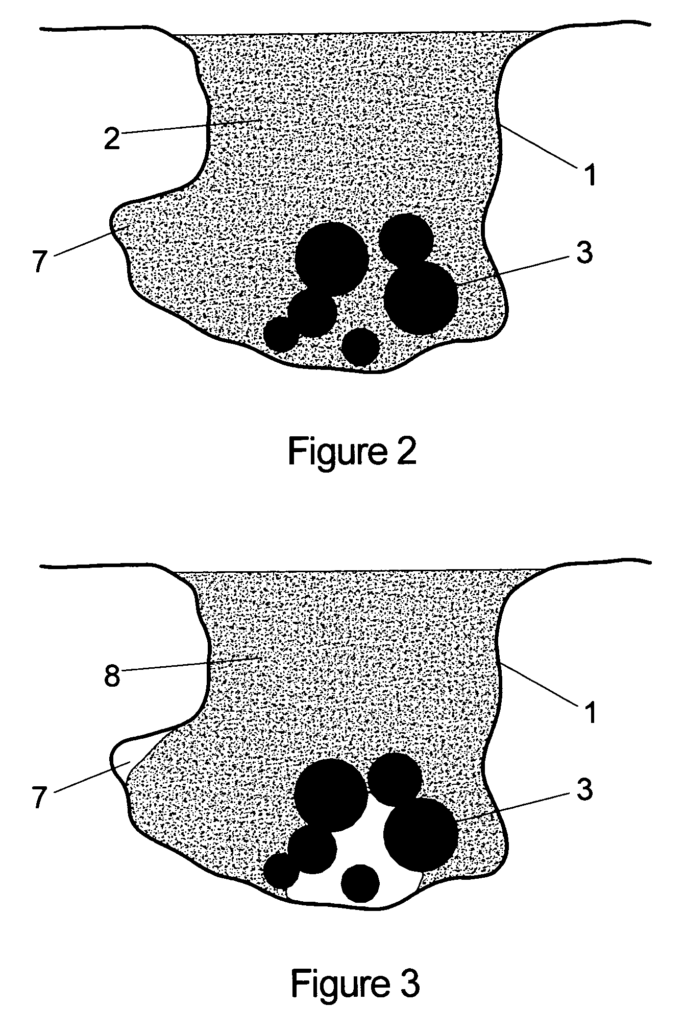 Flowable fill and flowable fill method for disposal of recovered waste