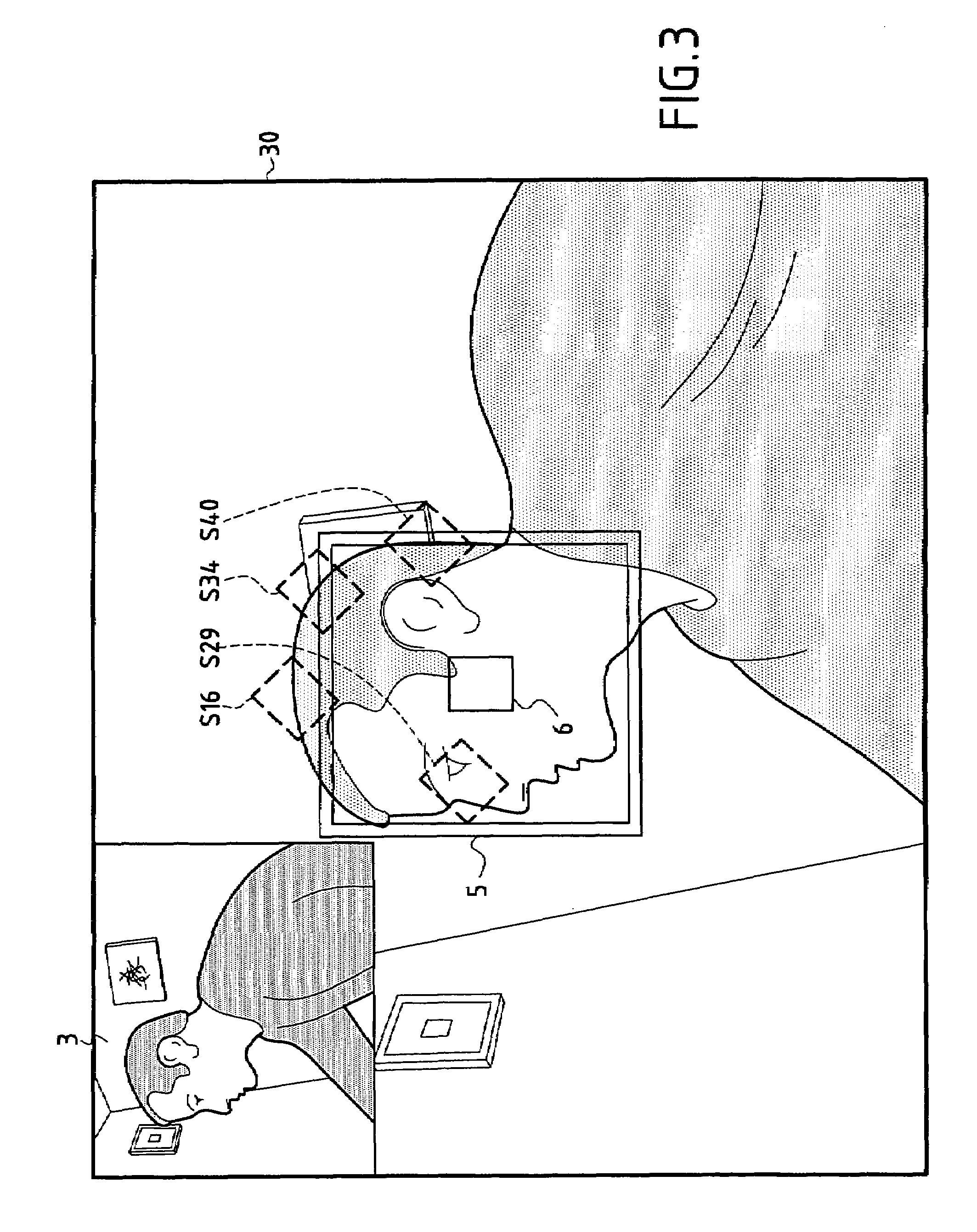 Adaptive artificial vision method and system