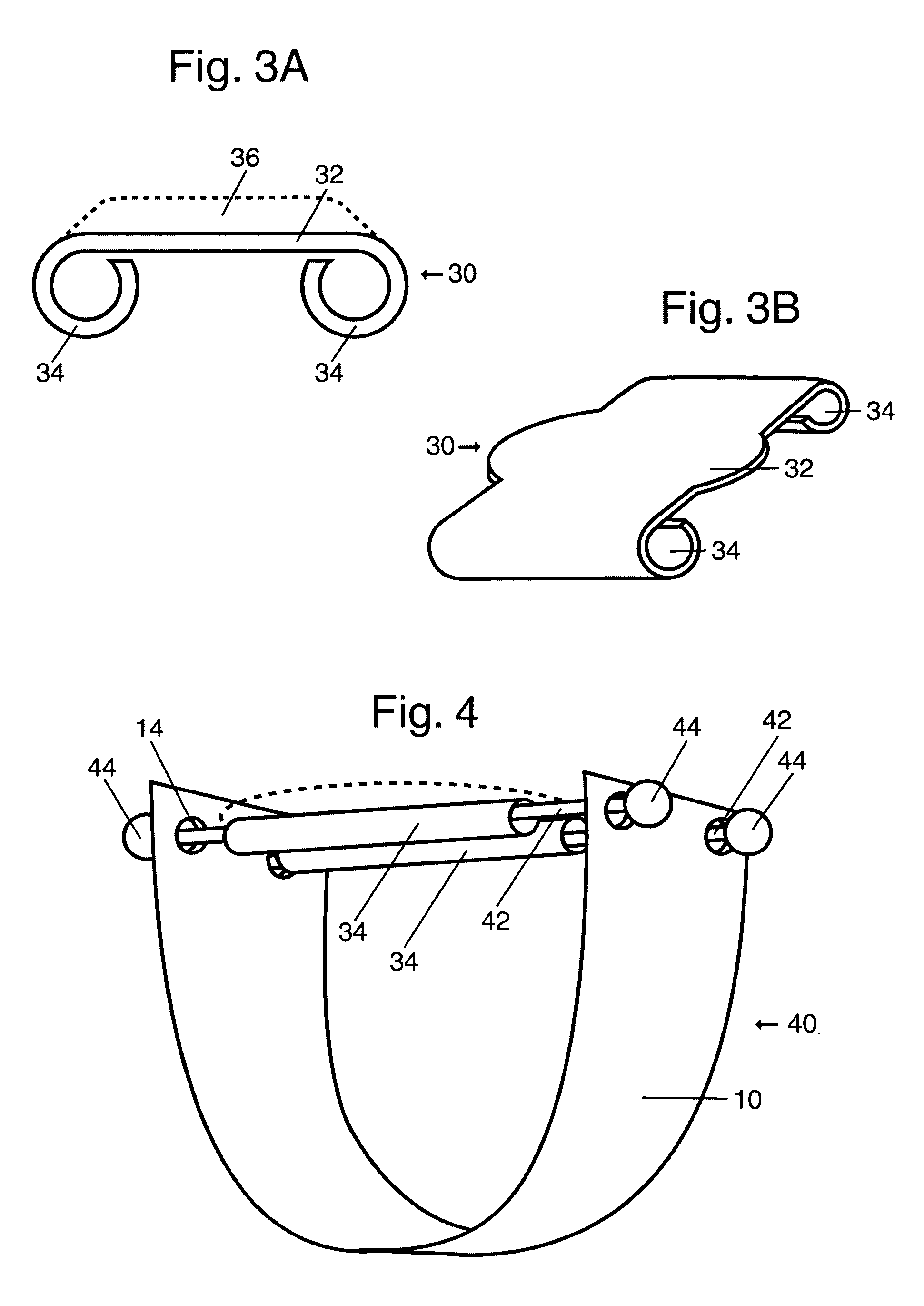 Ornamental ring and assembly method