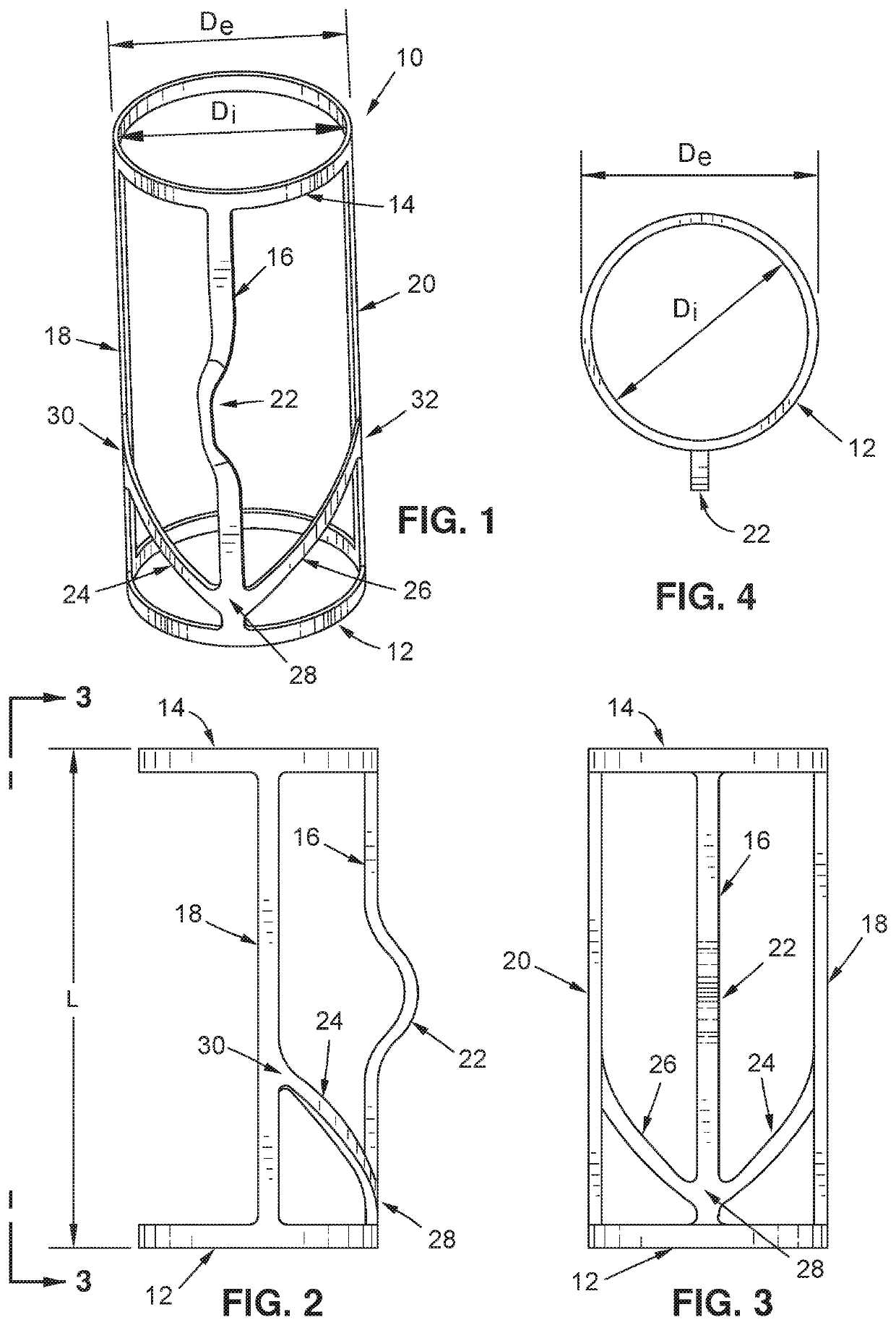 Implantable vein frame