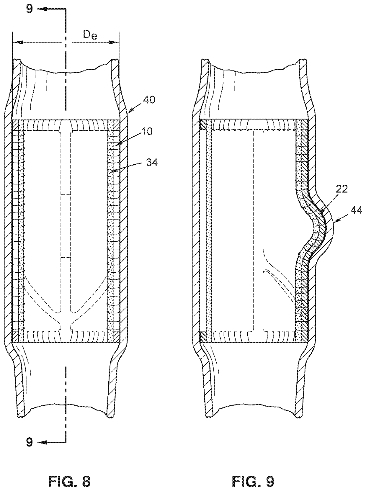 Implantable vein frame